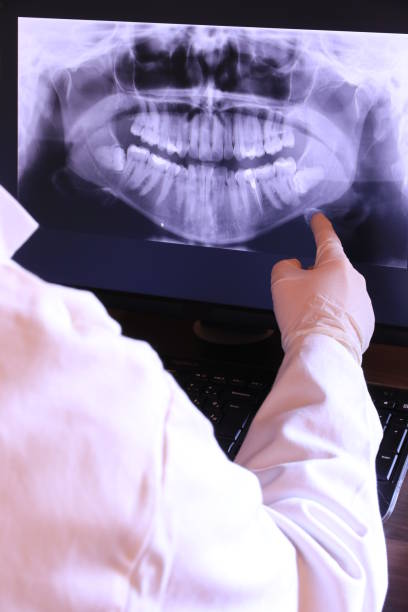 Best Emergency Dentist for Lost Fillings or Crowns in De Soto, IA